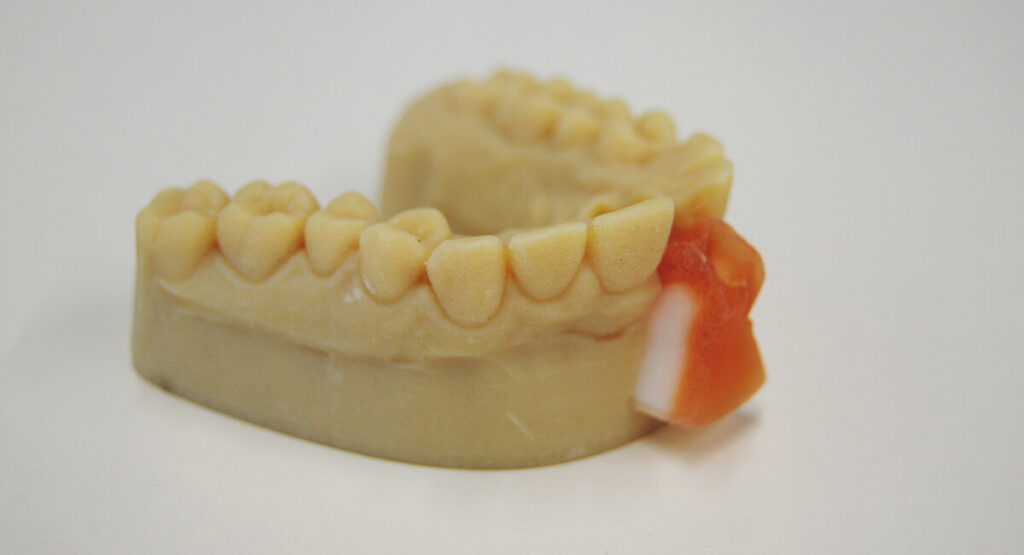 biomodels for dentistry