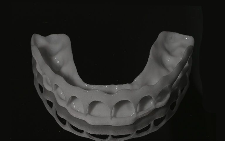 Férula de gingivectomía
